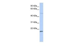 ZNF79 Antibody, Novus Biologicals 100 &mu;L; Unconjugated:Antibodies, Polyclonal